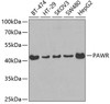 Cell Death Antibodies 1 Anti-PAWR Antibody CAB3063