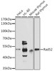 Epigenetics and Nuclear Signaling Antibodies 3 Anti-Rad52 Antibody CAB3077