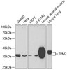 Cell Biology Antibodies 8 Anti-TPM2 Antibody CAB3096