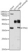 Cell Biology Antibodies 8 Anti-TPM2 Antibody CAB3096