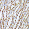 Cell Biology Antibodies 8 Anti-PPP2CB Antibody CAB3122