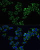 Cell Biology Antibodies 8 Anti-FSHR Antibody CAB3172