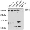 Immunology Antibodies 2 Anti-SETD2 Antibody CAB3194