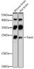 Cell Biology Antibodies 8 Anti-Twist Antibody CAB3237