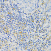 Cell Death Antibodies 1 Anti-PAK1 Antibody CAB3279