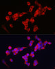Cell Biology Antibodies 8 Anti-KIF5A Antibody CAB3303