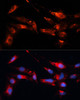 Cell Biology Antibodies 8 Anti-MAP1B Antibody CAB3305
