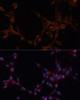 Cell Biology Antibodies 8 Anti-ALDH6A1 Antibody CAB3309