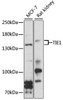 Cardiovascular Antibodies Anti-TIE1 Antibody CAB3334