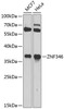 Cell Biology Antibodies 8 Anti-ZNF346 Antibody CAB3397