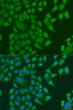 Cell Biology Antibodies 8 Anti-SUGCT Antibody CAB3499