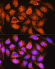 Cell Biology Antibodies 8 Anti-ALDH1B1 Antibody CAB3725