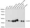 Metabolism Antibodies 2 Anti-ALDOB Antibody CAB3728