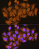 Signal Transduction Antibodies 2 Anti-ATP6V1E1 Antibody CAB3756