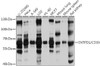 Cell Biology Antibodies 9 Anti-ENTPD1/CD39 Antibody CAB3778