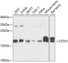 Cell Cycle Antibodies 1 Anti-CETN1 Antibody CAB3784