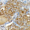 Cell Cycle Antibodies 1 Anti-CYLD Antibody CAB3821