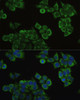 Metabolism Antibodies 2 Anti-ECHS1 Antibody CAB3845