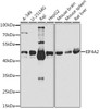 Immunology Antibodies 2 Anti-EIF4A2 Antibody CAB3849