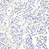 Signal Transduction Antibodies 2 Anti-FKBP5 Antibody CAB3863