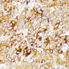 Metabolism Antibodies 2 Anti-GALC Antibody CAB3873