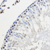 Cell Biology Antibodies 9 Anti-HNRNPU Antibody CAB3917