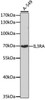 Cell Biology Antibodies 9 Anti-IL-3RA Antibody CAB3926