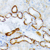 Cell Biology Antibodies 9 Anti-IL-3RA Antibody CAB3926