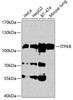 Cell Biology Antibodies 9 Anti-ITPKB Antibody CAB3929