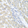 Cell Biology Antibodies 9 Anti-ITPKB Antibody CAB3929