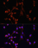 Immunology Antibodies 2 Anti-MOV10 Antibody CAB3966