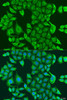 Metabolism Antibodies 2 Anti-PDK2 Antibody CAB4012