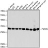 Metabolism Antibodies 2 Anti-PGAM1 Antibody CAB4015