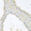 Cell Biology Antibodies 9 Anti-PMM2 Antibody CAB4026