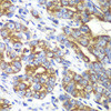 Cell Death Antibodies 2 Anti-RALB Antibody CAB4069