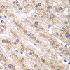 Cell Death Antibodies 2 Anti-RALB Antibody CAB4069