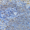 Cell Biology Antibodies 9 Anti-RPL23A Antibody CAB4086