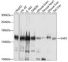 Metabolism Antibodies 2 Anti-VARS Antibody CAB4182