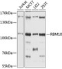 Epigenetics and Nuclear Signaling Antibodies 3 Anti-RBM10 Antibody CAB4209