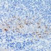 Immunology Antibodies 2 Anti-IFITM1 Antibody CAB4228