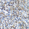 KO Validated Antibodies 1 Anti-ARHGEF1 Antibody CAB4274KO Validated