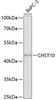 Metabolism Antibodies 2 Anti-CHST10 Antibody CAB4307