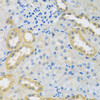 Cell Biology Antibodies 9 Anti-PMPCB Antibody CAB4312