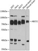 Cell Biology Antibodies 9 Anti-ABCF2 Antibody CAB4365