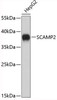 Cell Biology Antibodies 9 Anti-SCAMP2 Antibody CAB4367