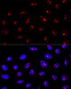 Cell Biology Antibodies 9 Anti-MYBBP1A Antibody CAB4429