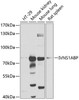 Immunology Antibodies 2 Anti-IVNS1ABP Antibody CAB4442