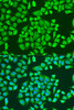 Epigenetics and Nuclear Signaling Antibodies 3 Anti-IGF2BP3 Antibody CAB4444