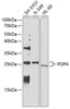 Epigenetics and Nuclear Signaling Antibodies 3 Anti-POP4 Antibody CAB4452