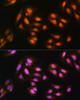 Cell Biology Antibodies 9 Anti-ADRM1 Antibody CAB4481